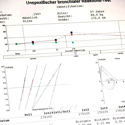 Histaminprovokation
