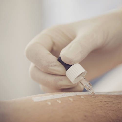 Allergietest (Prick-Test, Reibe-Test, Scratch-Test, Intracutan-Test)